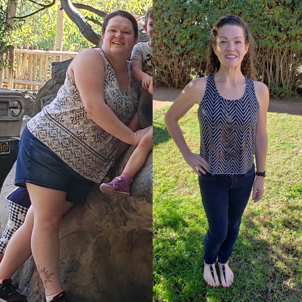 bariatric-surgery-splitscreen Bariatric Surgery Before and After Pictures